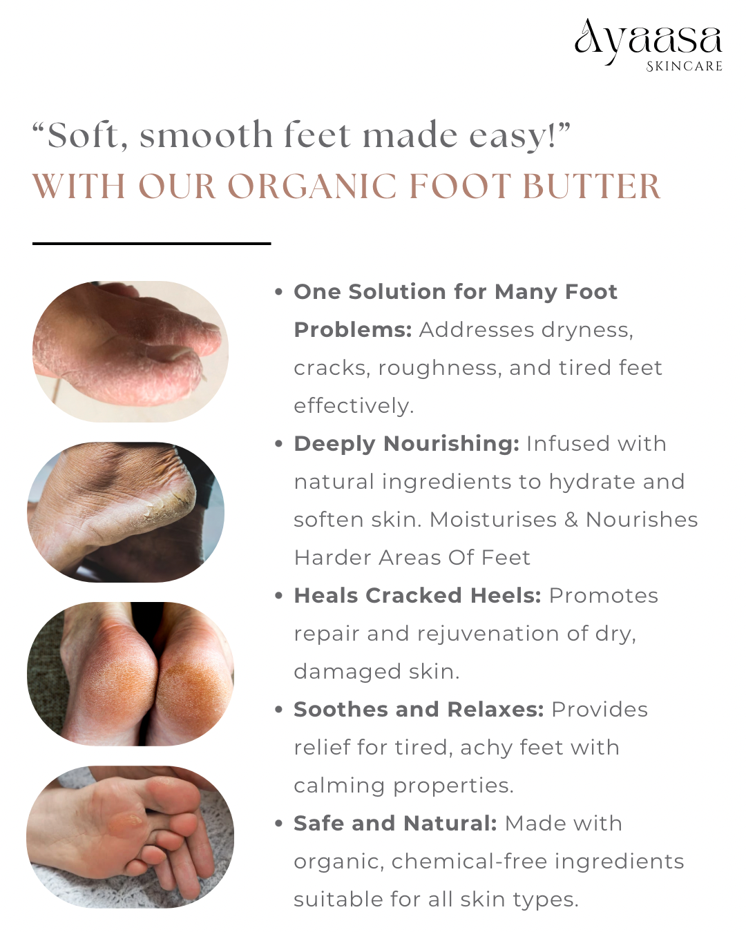 Organic Foot Butter – 50g