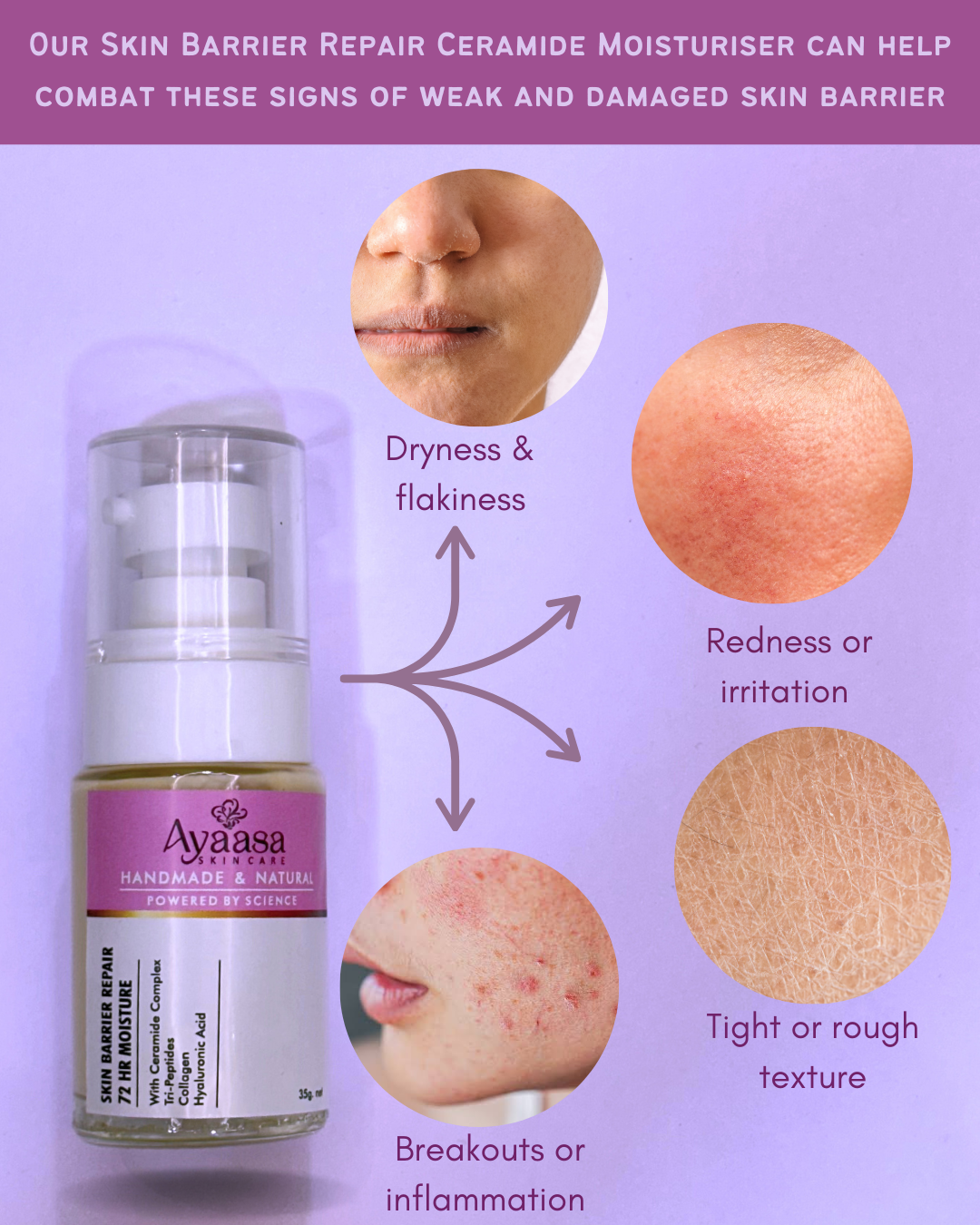 Skin Barrier Repair Moisturiser | 72hr Moisture | Ceramide Complex
