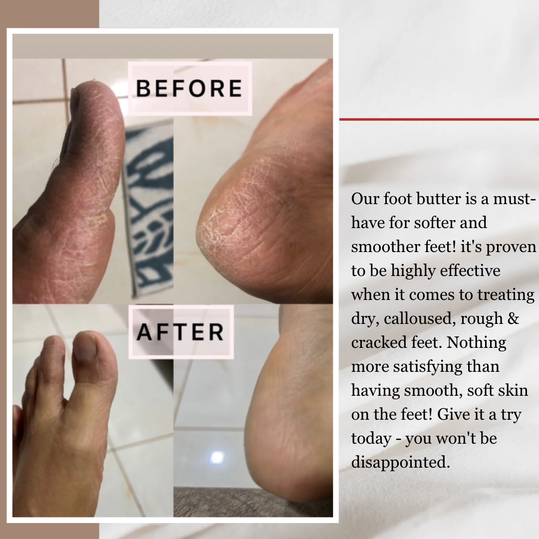 Organic Foot Butter – 50g