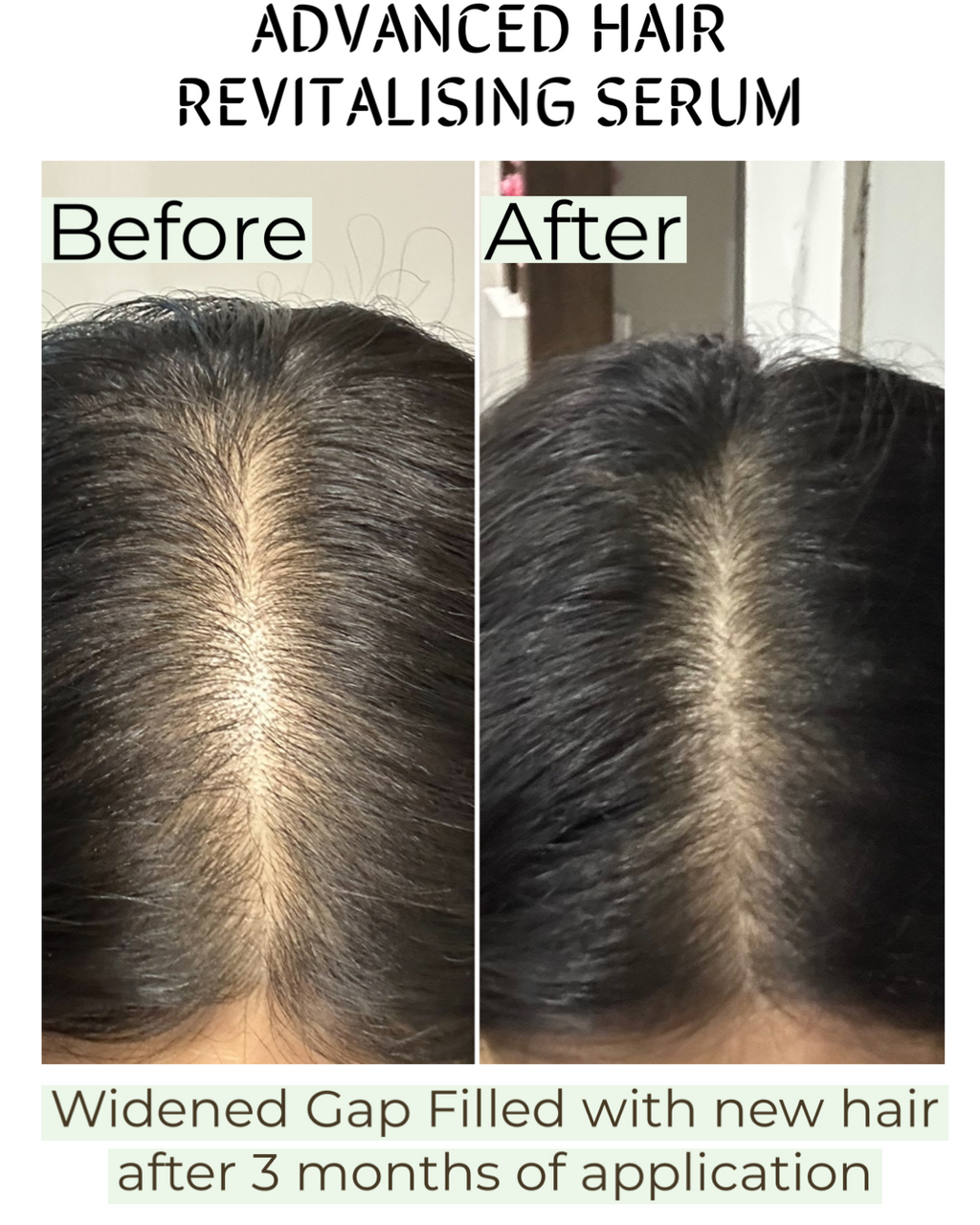 Advanced Revitalising Hair Regrowth Serum 30ml - Transform your hair care routine and reclaim your confidence—because stronger, healthier hair starts from the roots